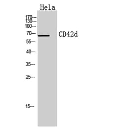 Western blot - CD42d Polyclonal Antibody from Signalway Antibody (41952) - Antibodies.com