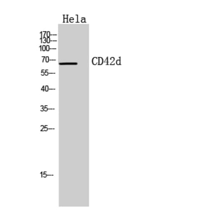 Western blot - CD42d Polyclonal Antibody from Signalway Antibody (41952) - Antibodies.com