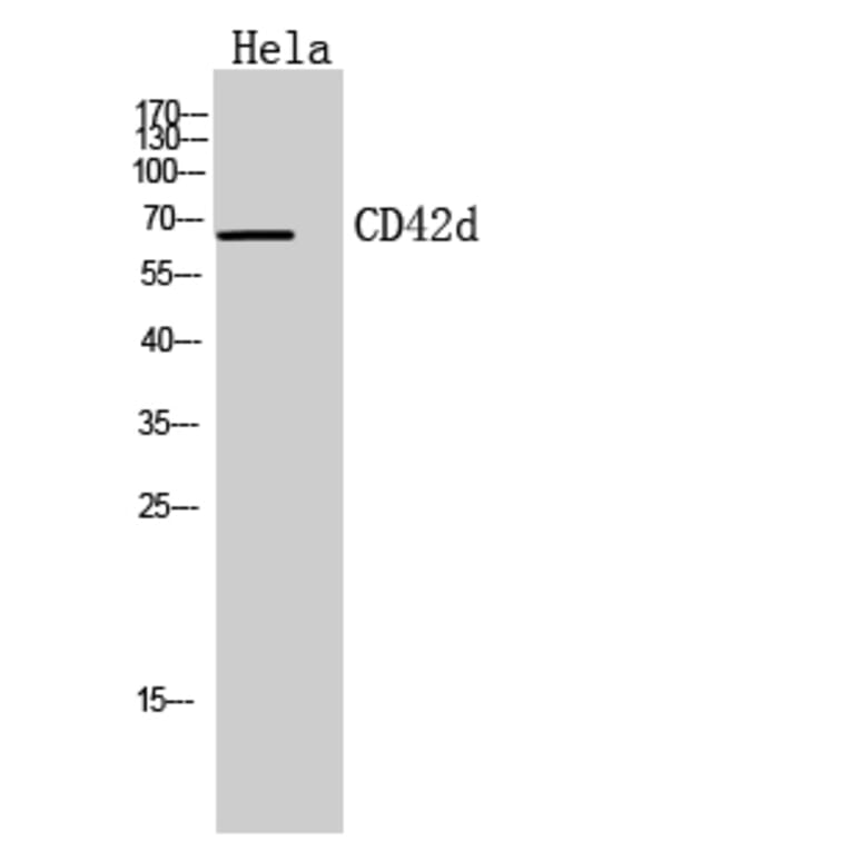 Western blot - CD42d Polyclonal Antibody from Signalway Antibody (41952) - Antibodies.com