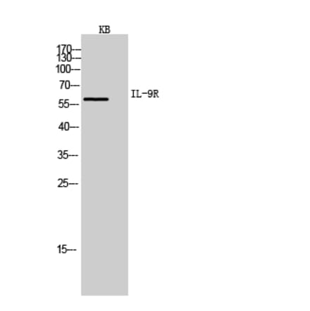 Western blot - IL-9R Polyclonal Antibody from Signalway Antibody (41971) - Antibodies.com