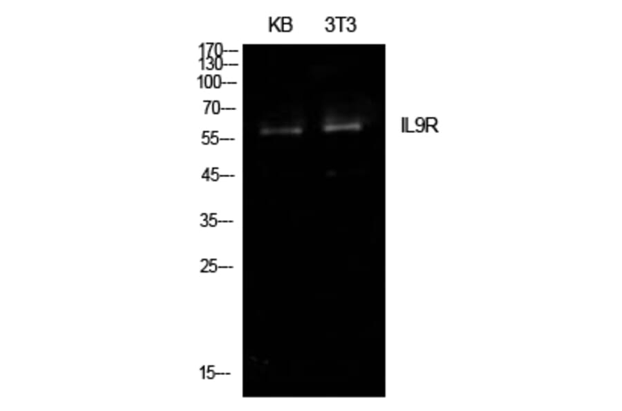 Western blot - IL-9R Polyclonal Antibody from Signalway Antibody (41971) - Antibodies.com