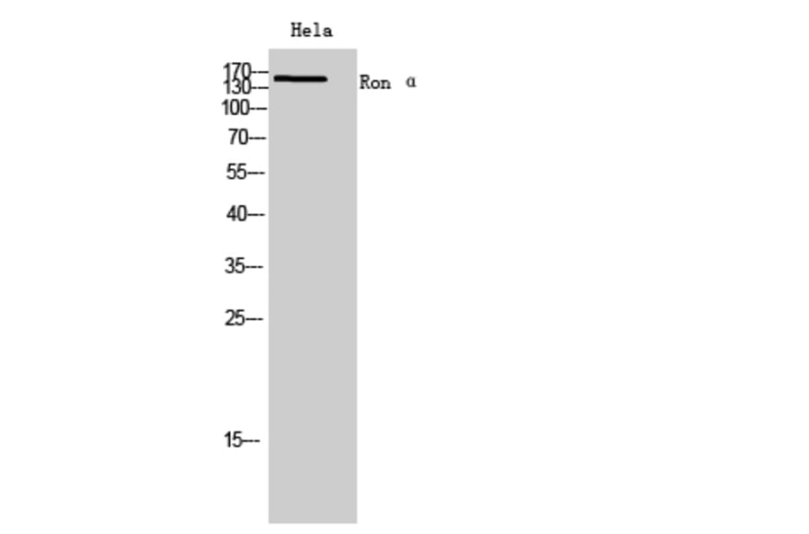 Western blot - Ron α Polyclonal Antibody from Signalway Antibody (41974) - Antibodies.com