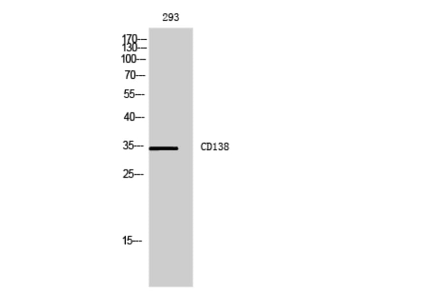 Western blot - CD138 Polyclonal Antibody from Signalway Antibody (41975) - Antibodies.com