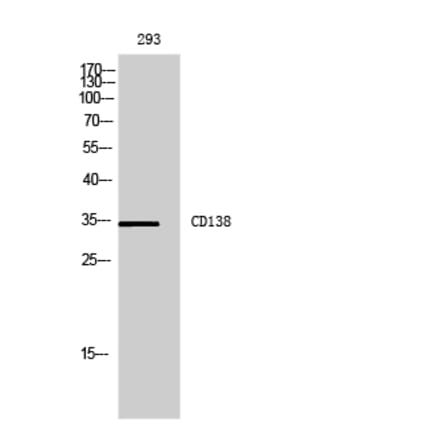 Western blot - CD138 Polyclonal Antibody from Signalway Antibody (41975) - Antibodies.com