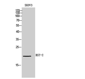 Western blot - BST-2 Polyclonal Antibody from Signalway Antibody (41977) - Antibodies.com