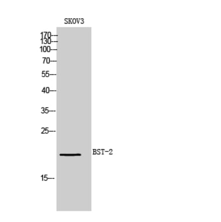 Western blot - BST-2 Polyclonal Antibody from Signalway Antibody (41977) - Antibodies.com