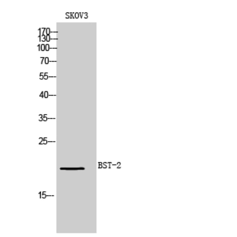 Western blot - BST-2 Polyclonal Antibody from Signalway Antibody (41977) - Antibodies.com