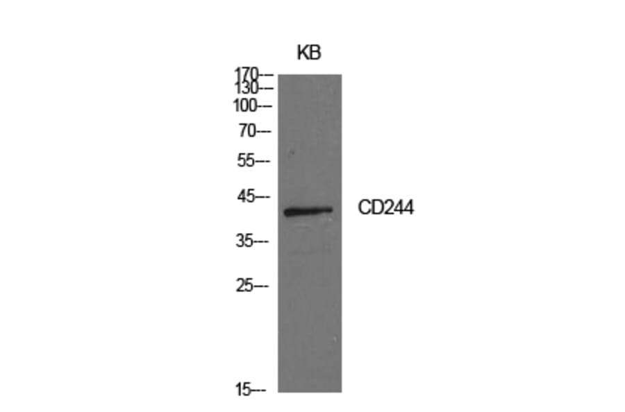Western blot - CD244 Polyclonal Antibody from Signalway Antibody (41980) - Antibodies.com