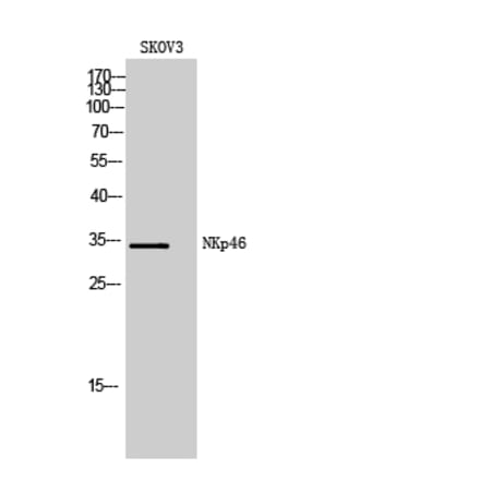 Western blot - NKp46 Polyclonal Antibody from Signalway Antibody (41985) - Antibodies.com