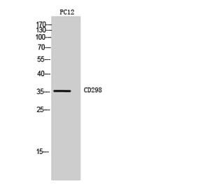 Western blot - CD298 Polyclonal Antibody from Signalway Antibody (41987) - Antibodies.com