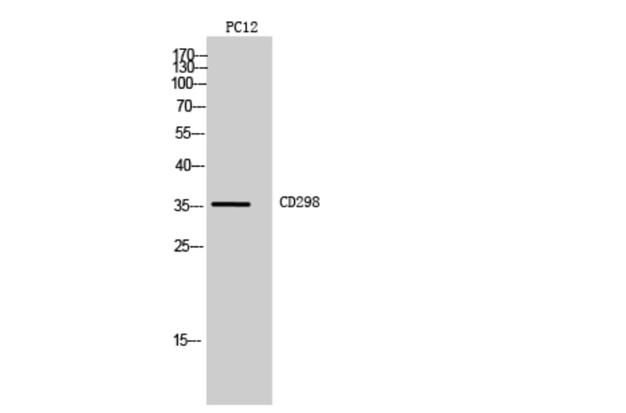 Western blot - CD298 Polyclonal Antibody from Signalway Antibody (41987) - Antibodies.com