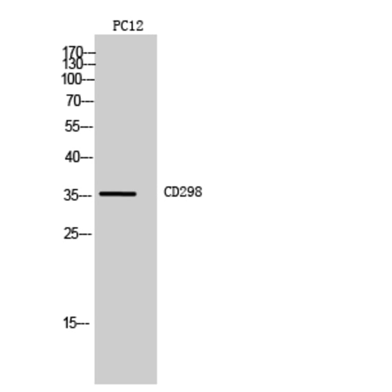 Western blot - CD298 Polyclonal Antibody from Signalway Antibody (41987) - Antibodies.com
