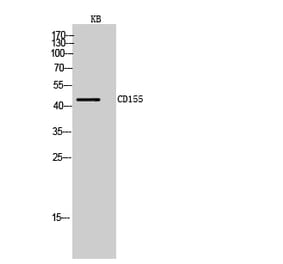 Western blot - CD155 Polyclonal Antibody from Signalway Antibody (41992) - Antibodies.com