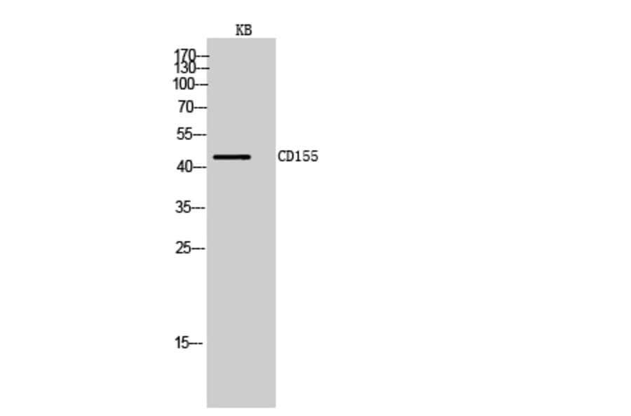 Western blot - CD155 Polyclonal Antibody from Signalway Antibody (41992) - Antibodies.com