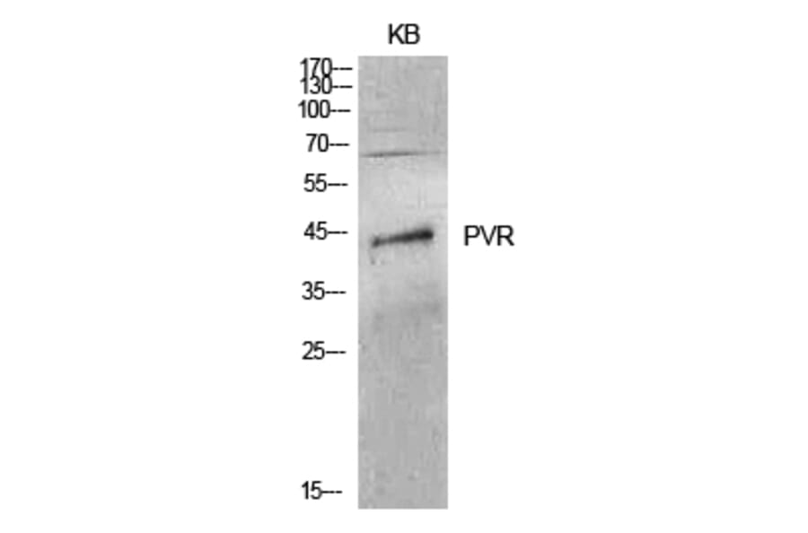 Western blot - CD155 Polyclonal Antibody from Signalway Antibody (41992) - Antibodies.com