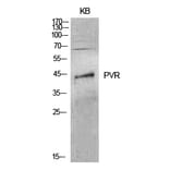 Western blot - CD155 Polyclonal Antibody from Signalway Antibody (41992) - Antibodies.com