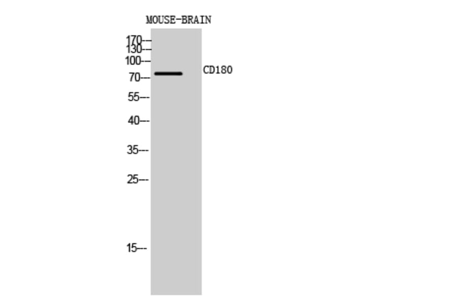Western blot - CD180 Polyclonal Antibody from Signalway Antibody (41993) - Antibodies.com