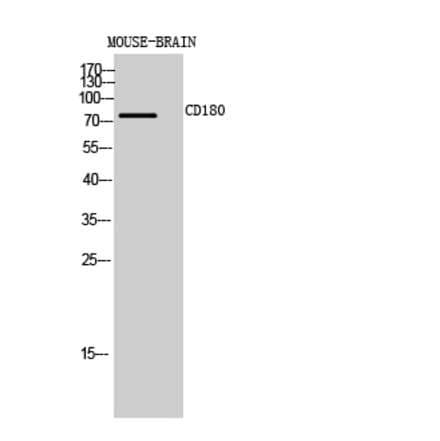 Western blot - CD180 Polyclonal Antibody from Signalway Antibody (41993) - Antibodies.com