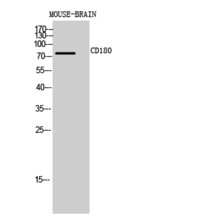 Western blot - CD180 Polyclonal Antibody from Signalway Antibody (41993) - Antibodies.com