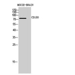 Western blot - CD180 Polyclonal Antibody from Signalway Antibody (41993) - Antibodies.com