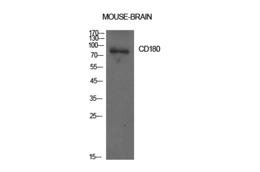 Western blot - CD180 Polyclonal Antibody from Signalway Antibody (41993) - Antibodies.com