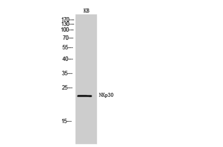 Western blot - NKp30 Polyclonal Antibody from Signalway Antibody (41995) - Antibodies.com