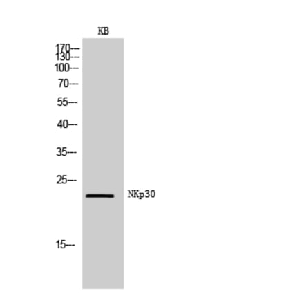 Western blot - NKp30 Polyclonal Antibody from Signalway Antibody (41995) - Antibodies.com