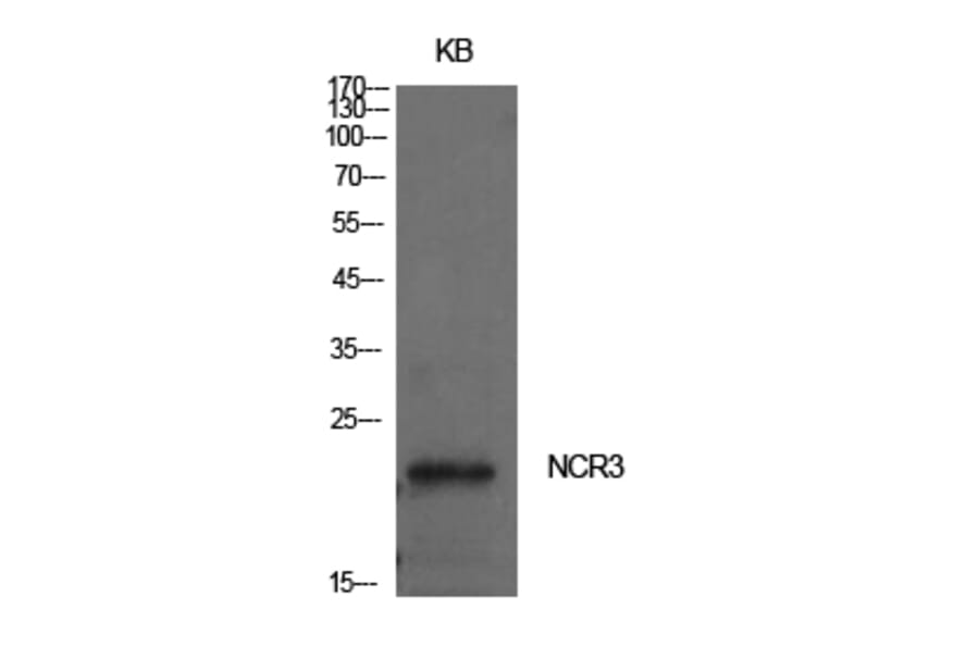 Western blot - NKp30 Polyclonal Antibody from Signalway Antibody (41995) - Antibodies.com