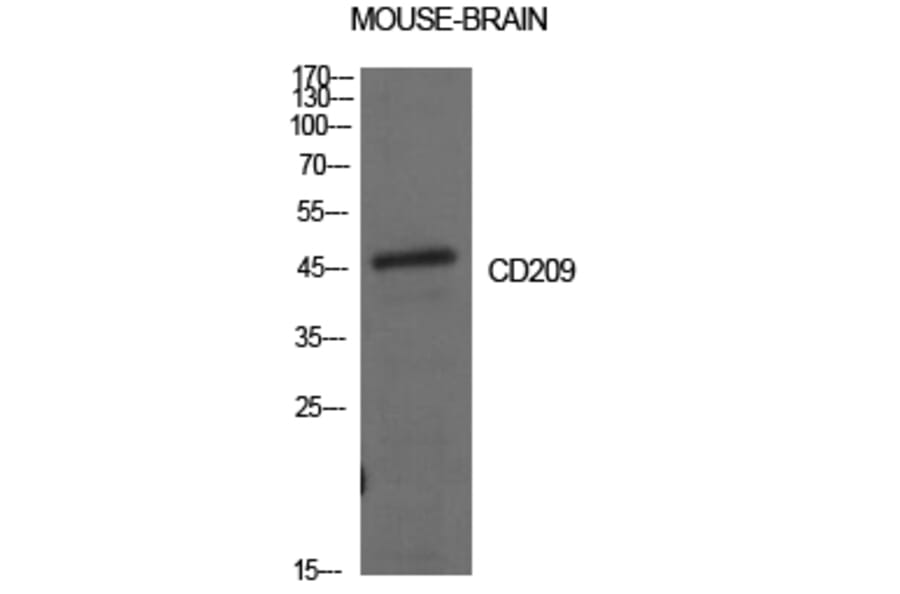 Western blot - CD209 Polyclonal Antibody from Signalway Antibody (41997) - Antibodies.com