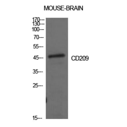 Western blot - CD209 Polyclonal Antibody from Signalway Antibody (41997) - Antibodies.com