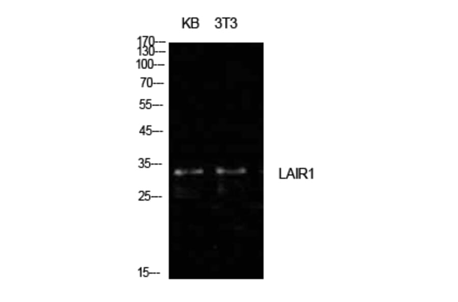 Western blot - CD305 Polyclonal Antibody from Signalway Antibody (41998) - Antibodies.com