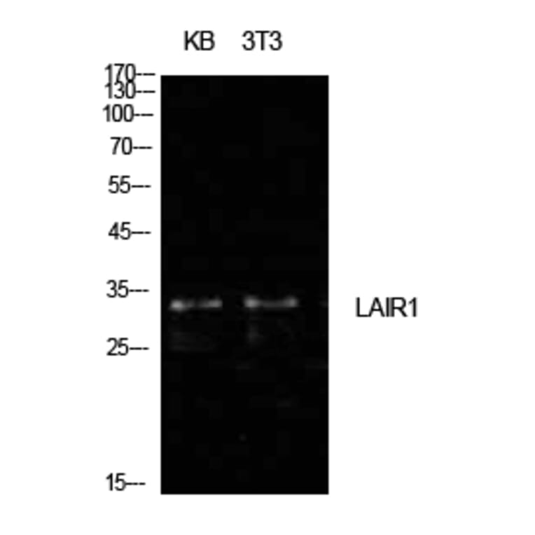 Western blot - CD305 Polyclonal Antibody from Signalway Antibody (41998) - Antibodies.com