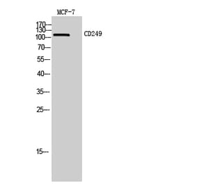 Western blot - CD249 Polyclonal Antibody from Signalway Antibody (42003) - Antibodies.com