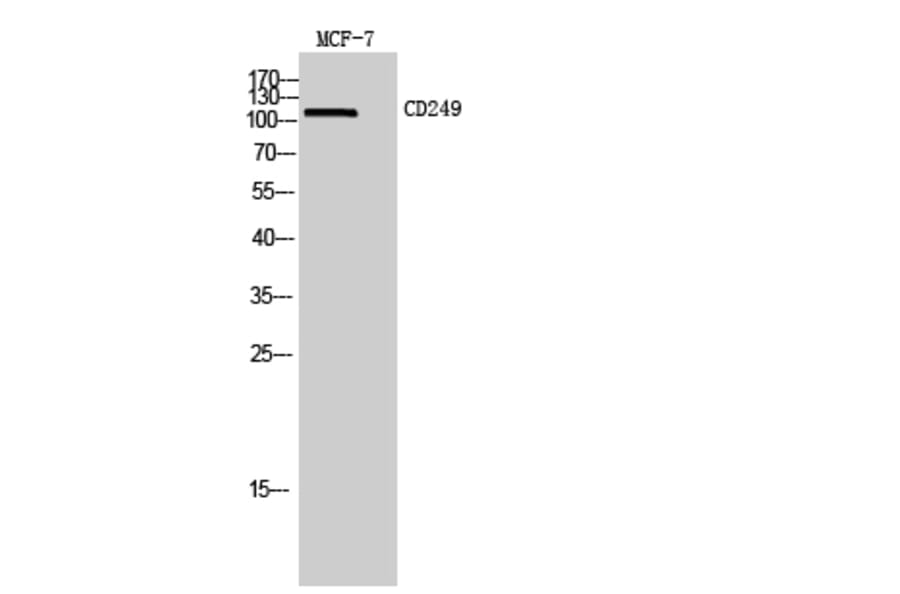 Western blot - CD249 Polyclonal Antibody from Signalway Antibody (42003) - Antibodies.com