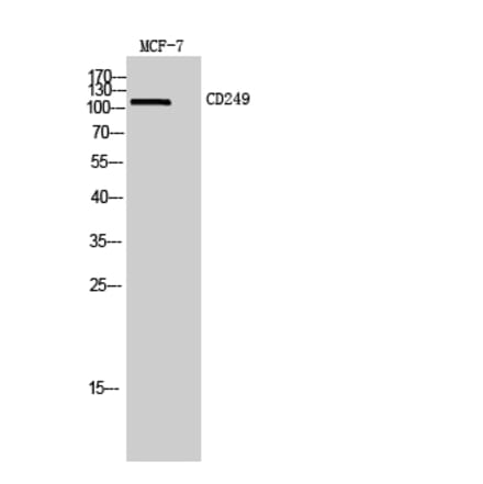 Western blot - CD249 Polyclonal Antibody from Signalway Antibody (42003) - Antibodies.com