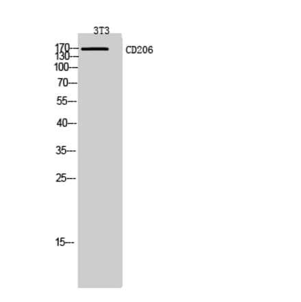 Western blot - CD206 Polyclonal Antibody from Signalway Antibody (42004) - Antibodies.com