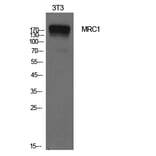 Western blot - CD206 Polyclonal Antibody from Signalway Antibody (42004) - Antibodies.com