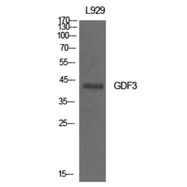 Western blot - GDF-3 Polyclonal Antibody from Signalway Antibody (42010) - Antibodies.com