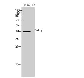 Western blot - Lefty Polyclonal Antibody from Signalway Antibody (42011) - Antibodies.com