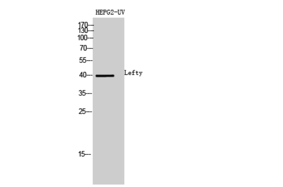Western blot - Lefty Polyclonal Antibody from Signalway Antibody (42011) - Antibodies.com