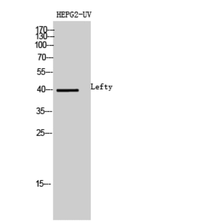 Western blot - Lefty Polyclonal Antibody from Signalway Antibody (42011) - Antibodies.com