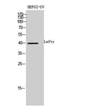 Western blot - Lefty Polyclonal Antibody from Signalway Antibody (42011) - Antibodies.com