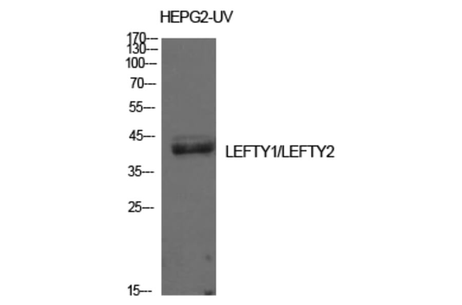 Western blot - Lefty Polyclonal Antibody from Signalway Antibody (42011) - Antibodies.com