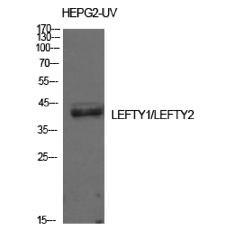 Western blot - Lefty Polyclonal Antibody from Signalway Antibody (42011) - Antibodies.com