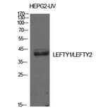 Western blot - Lefty Polyclonal Antibody from Signalway Antibody (42011) - Antibodies.com