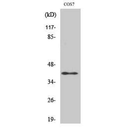 Western blot - ADH7 Polyclonal Antibody from Signalway Antibody (40556) - Antibodies.com