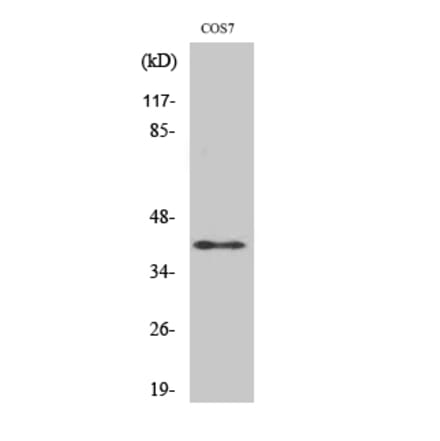 Western blot - ADH7 Polyclonal Antibody from Signalway Antibody (40556) - Antibodies.com