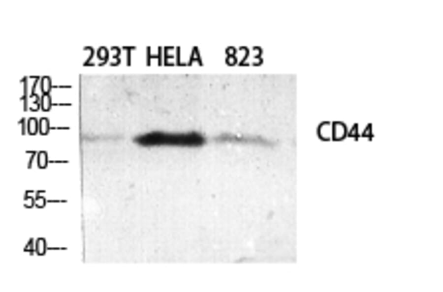 Western blot - CD44 Polyclonal Antibody from Signalway Antibody (40702) - Antibodies.com