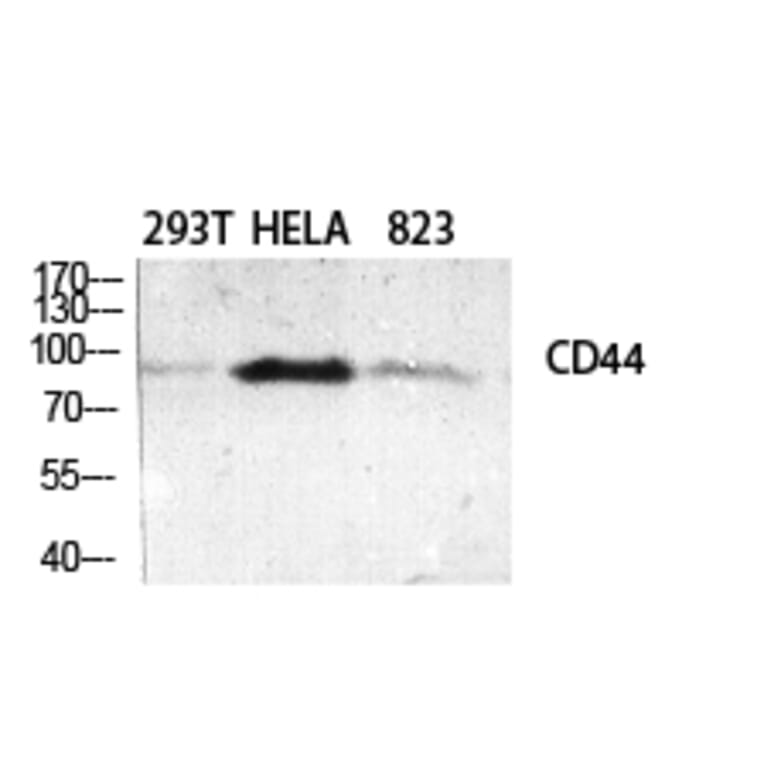 Western blot - CD44 Polyclonal Antibody from Signalway Antibody (40702) - Antibodies.com