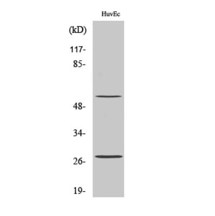Western blot - CD69 Polyclonal Antibody from Signalway Antibody (40703) - Antibodies.com